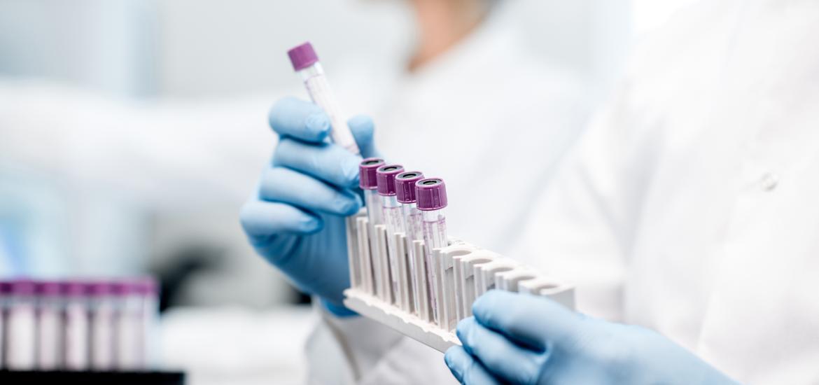 Triple meeting 2025 – Halda’s proximity play in prostate