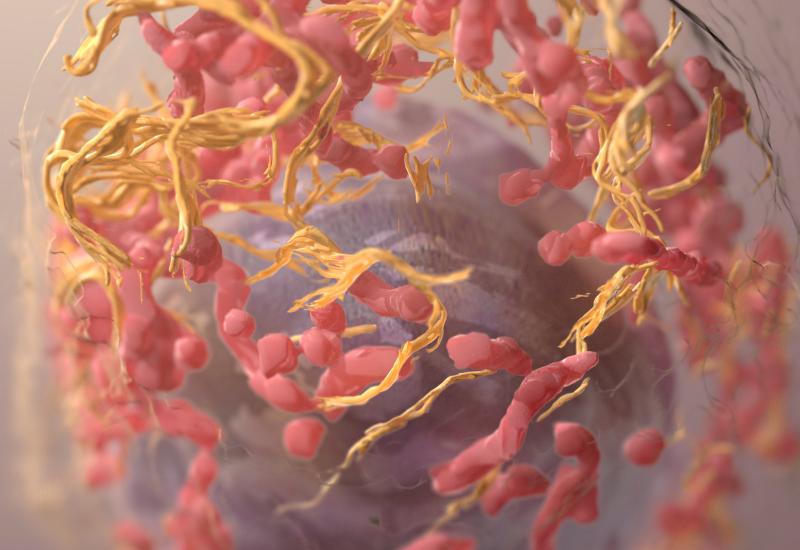 Melanoma cell