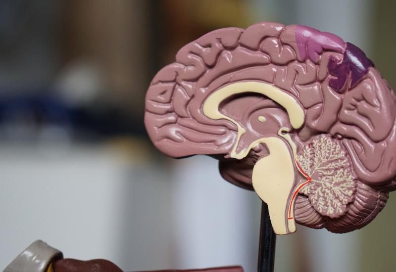 Model of a brain